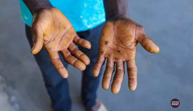 Labour relations, working conditions of workers, smallholder cocoa farms, Ghana, Evans Appiah Kissi, Uriah Nkrumah, cocoa poverty,